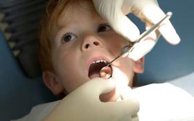 مهم‌ترین عامل پوسیدگی دندان در کودکان